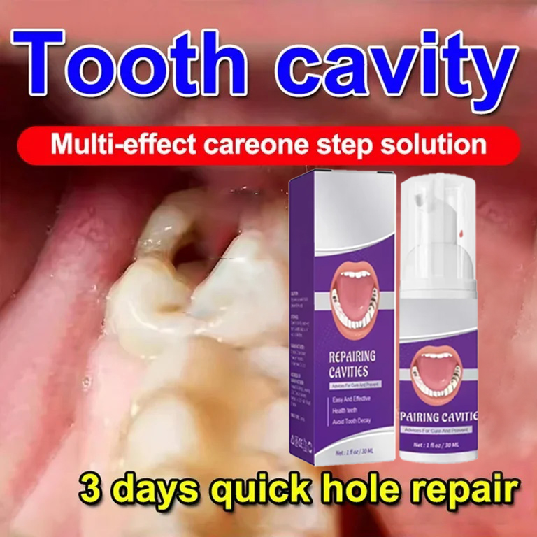 Teeth Whitening That Works - Teeth Cleaning Toothpaste Removes Tooth Stains