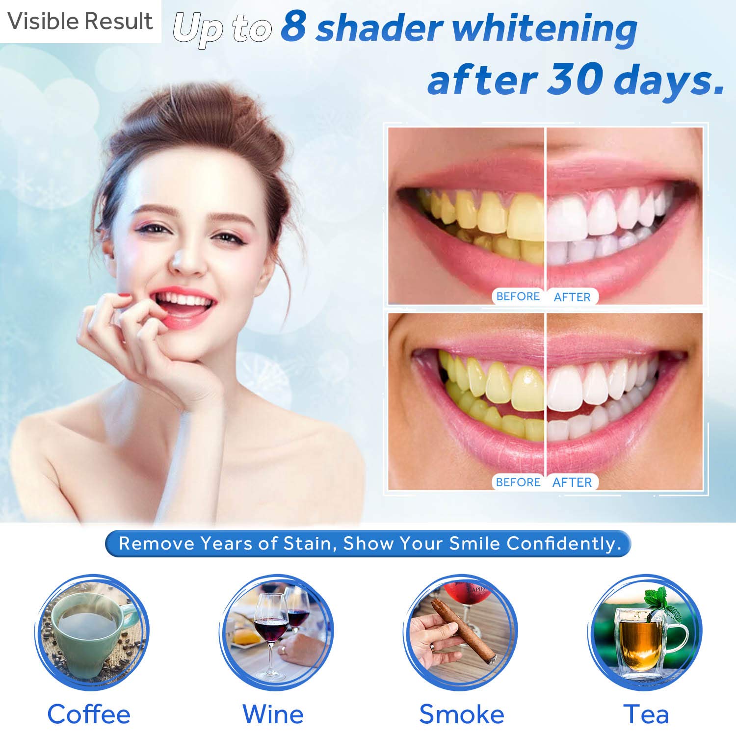 Teeth Whitening Gel Refill Syr - Teeth Whitening Singapore ulasan dan harga