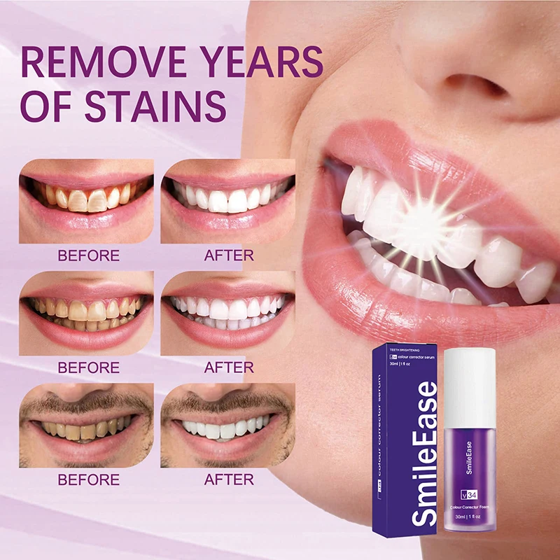 45ml Smilekit Purple Tooth Mou - Teeth Whitening Foam ulasan dan harga
