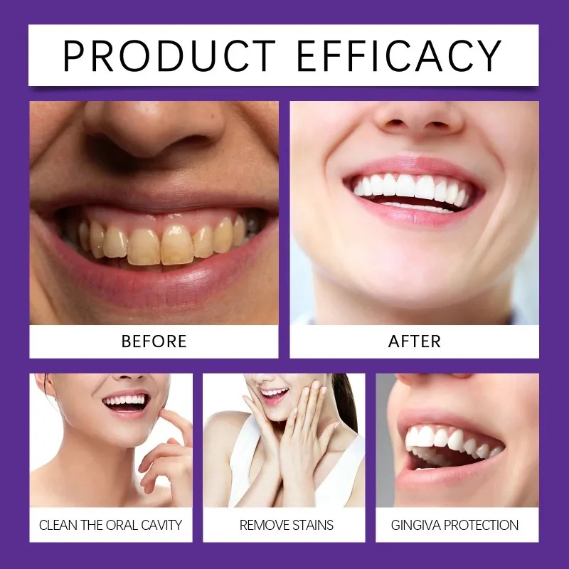 Purple Teeth Restoration Miner - Teeth Whitening That Works ulasan dan harga