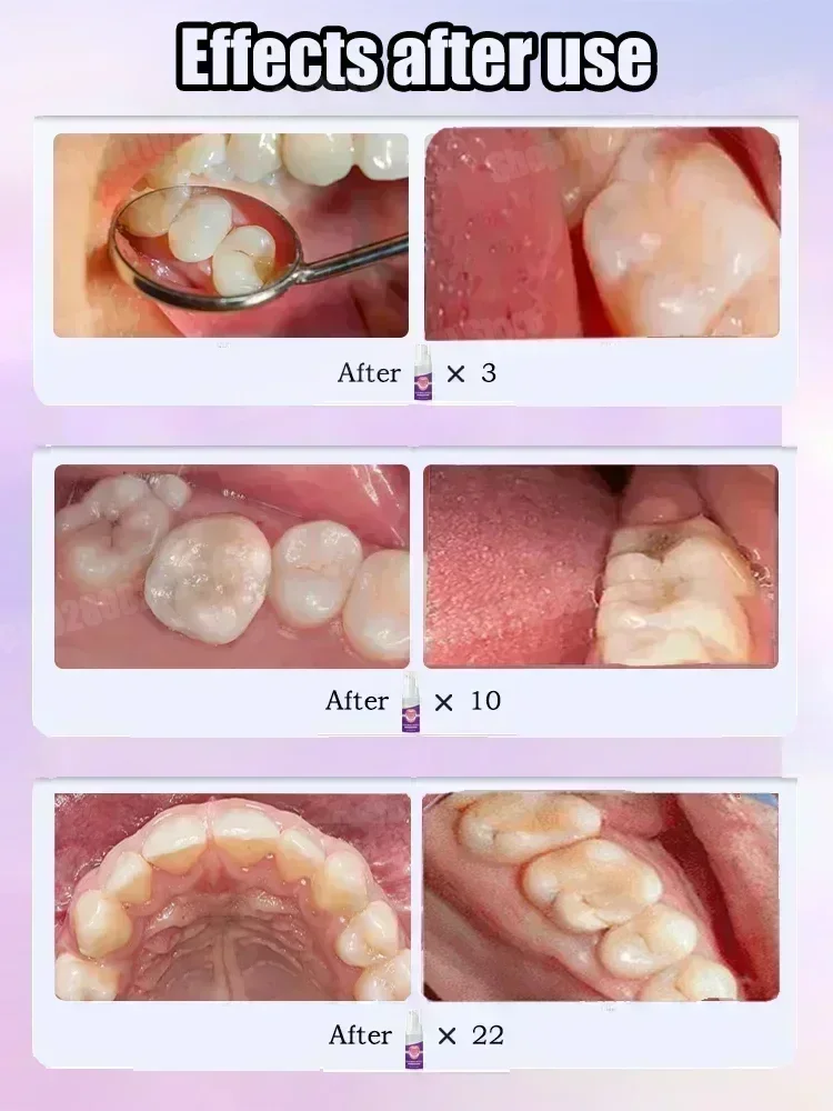 Teeth Cleaning Toothpaste Remo - Teeth Whitening That Works ulasan dan harga