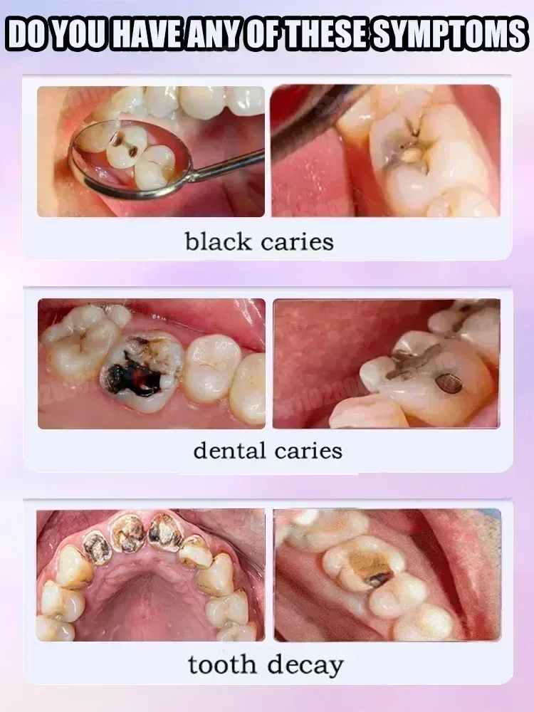 Teeth Cleaning Toothpaste Remo - Teeth Whitening That Works ulasan dan harga